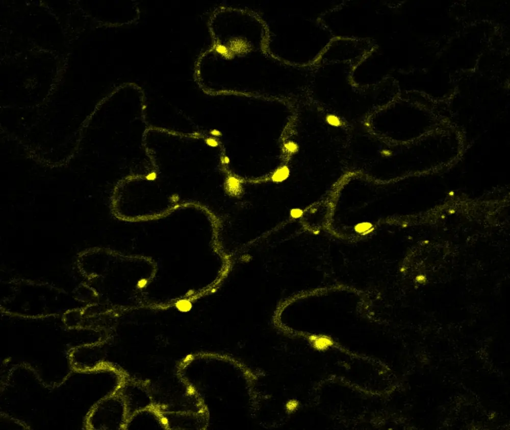 Fluorescence micrograph of biomolecular condensates in plant cells